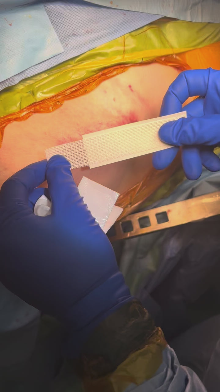 Load video: TKA Application – Robert Benjamin Jones, MD