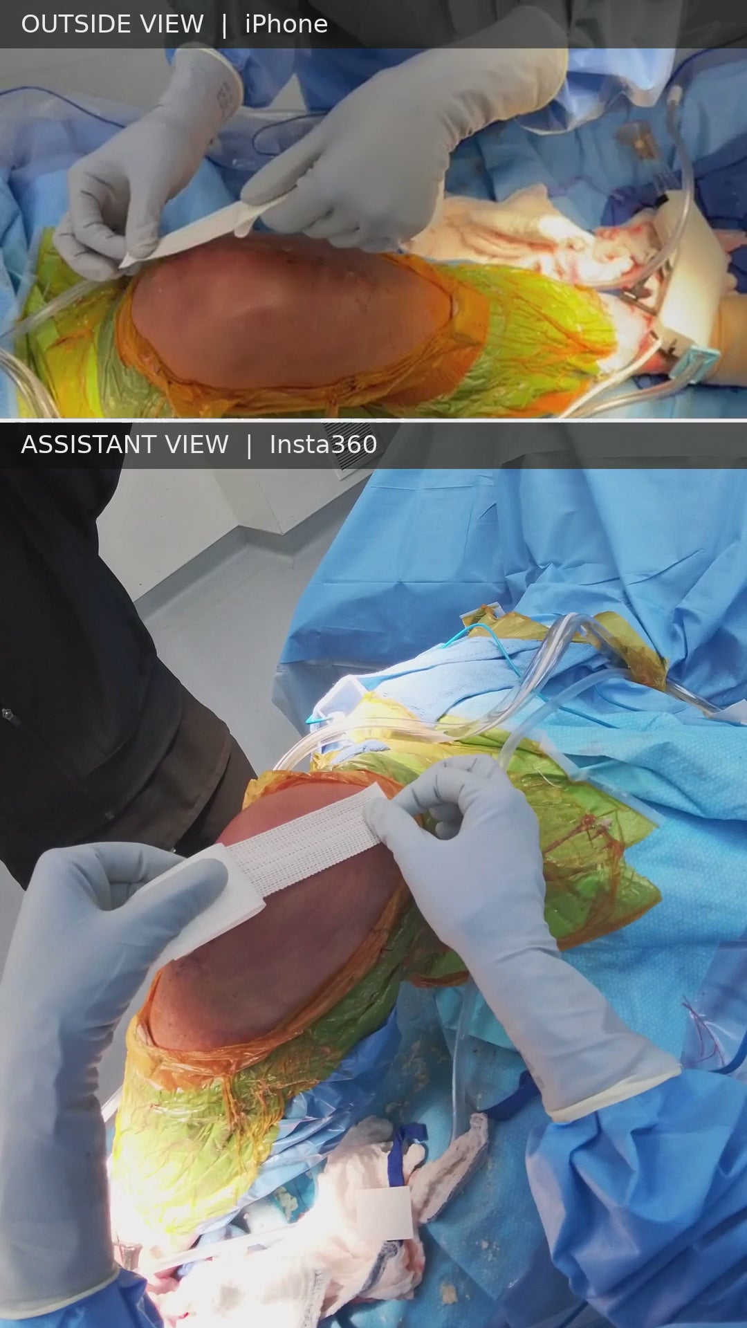 Load video: TKA Application – Steven K. Nishiyama, D.O., Ph.D.
