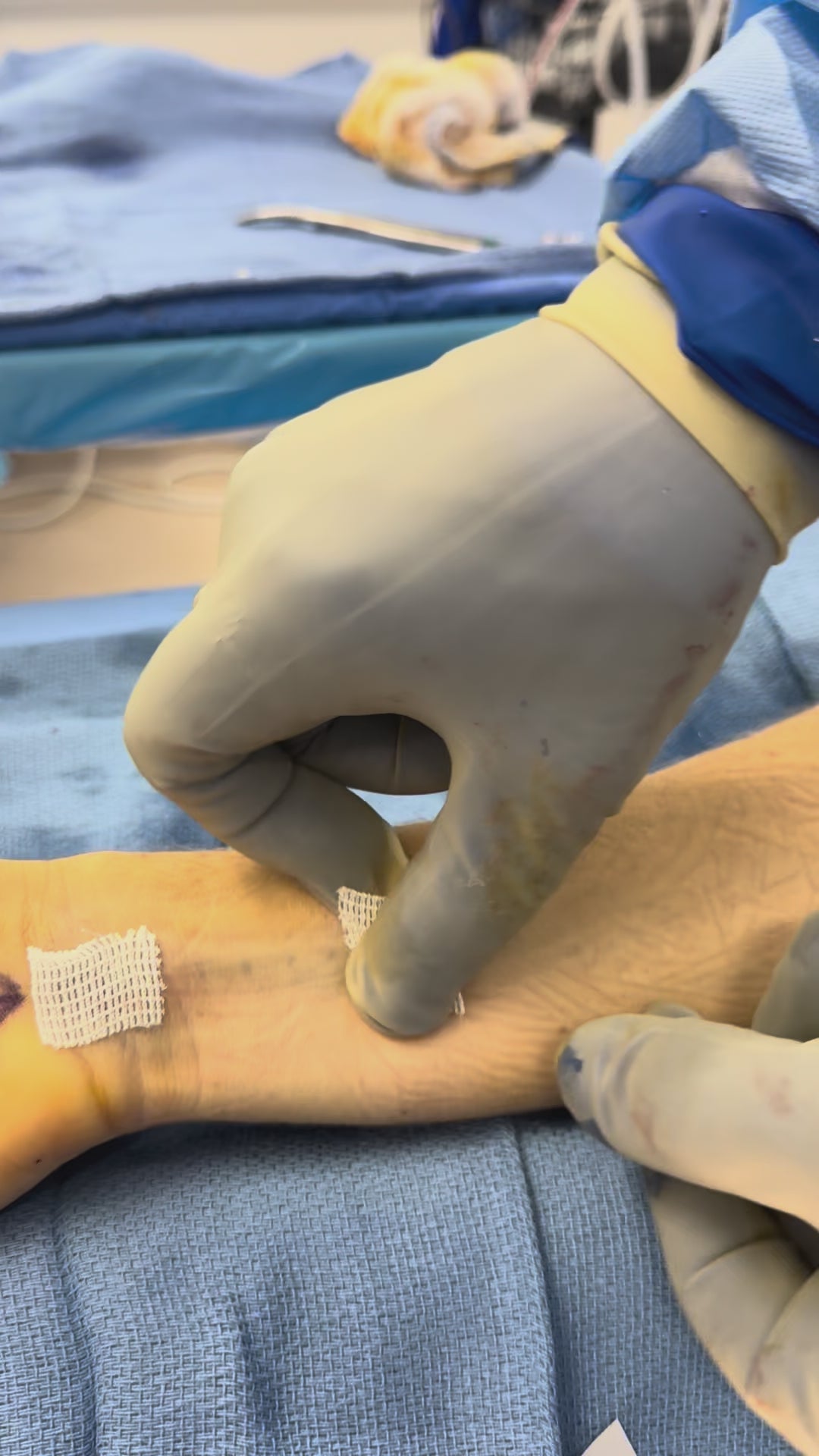 Load video: Tommy John Application – Raffy Mirzayan, MD