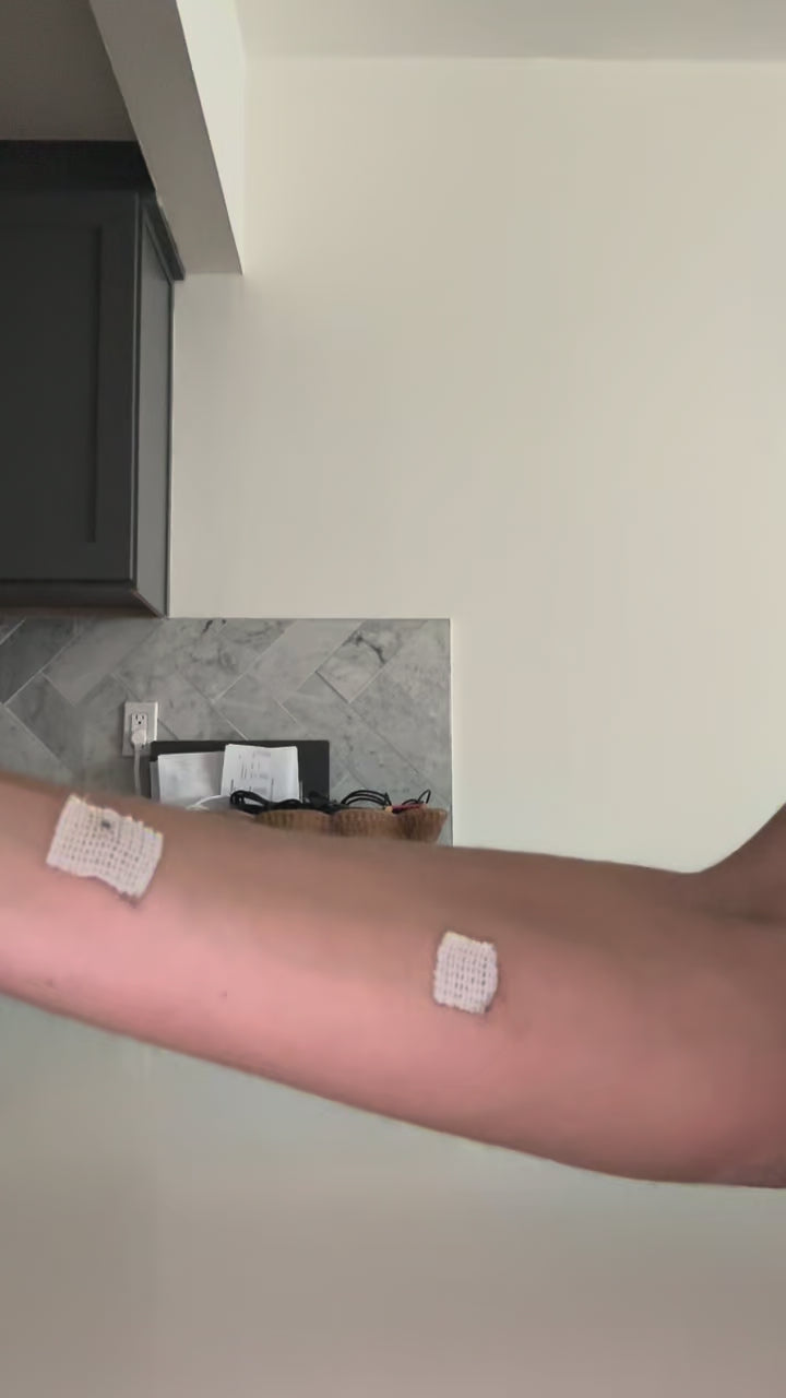 Load video: Tommy John Removal – Raffy Mirzayan, MD